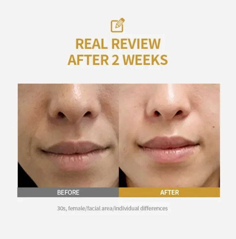 Deep Collagen Essence - Peptide Intensive Activation, Pink PDRN Stem Cell Ampoule, Brightening, Moisturizing, Skincare